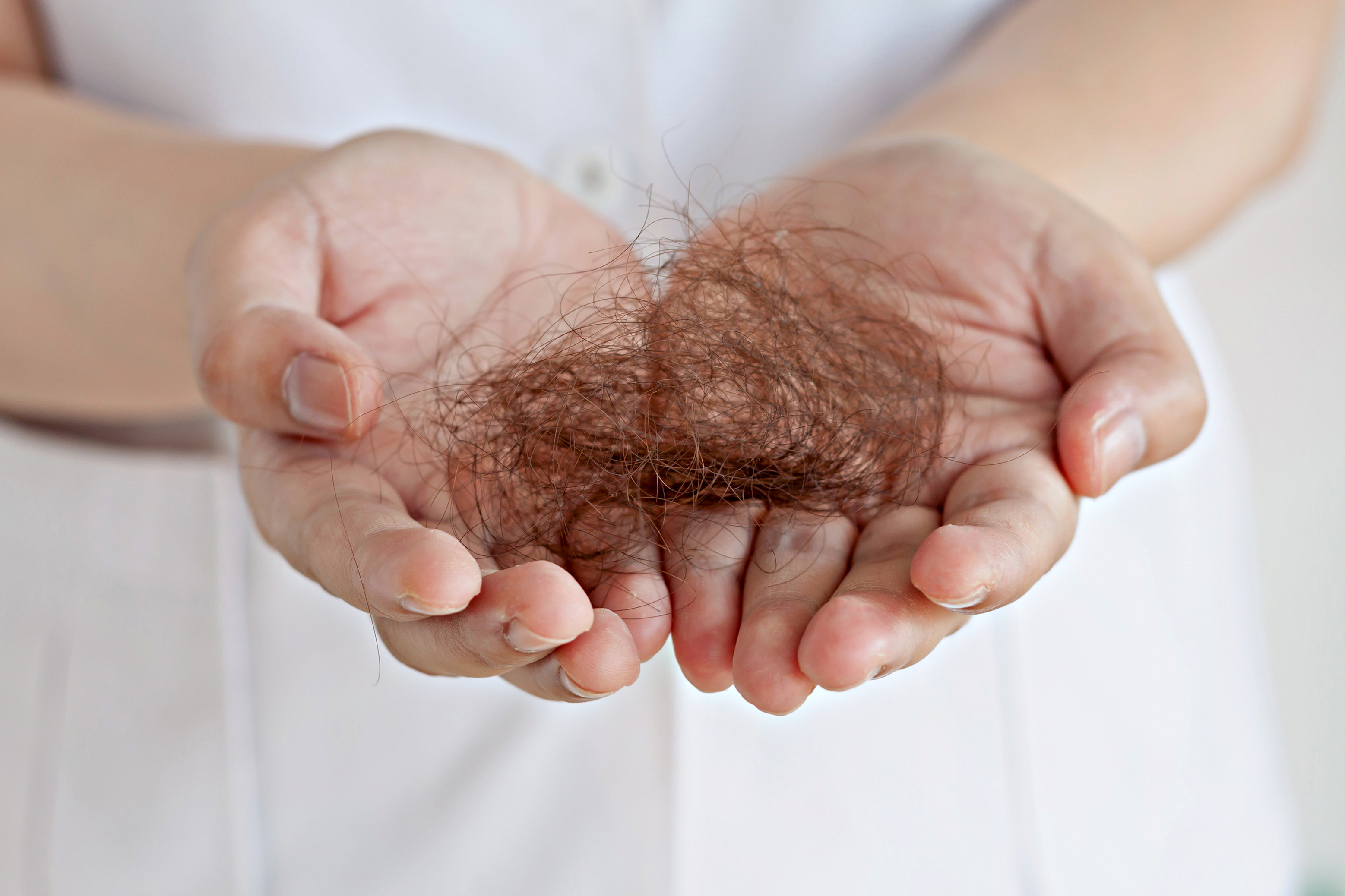 POSTPARTUM HAIR LOSS