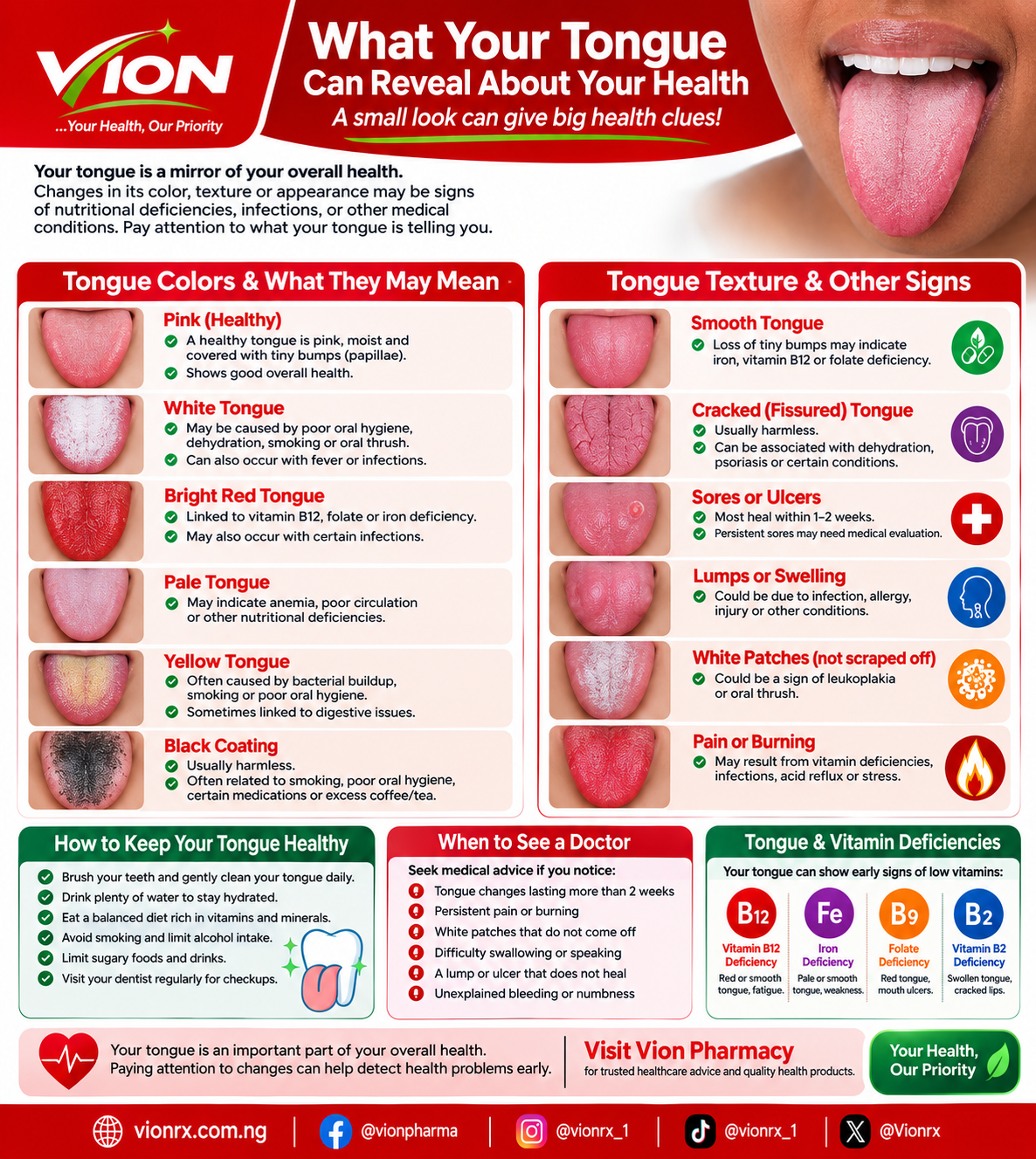 What Your Tongue Can Reveal About Your Health: Signs, Causes, and When to See a Doctor