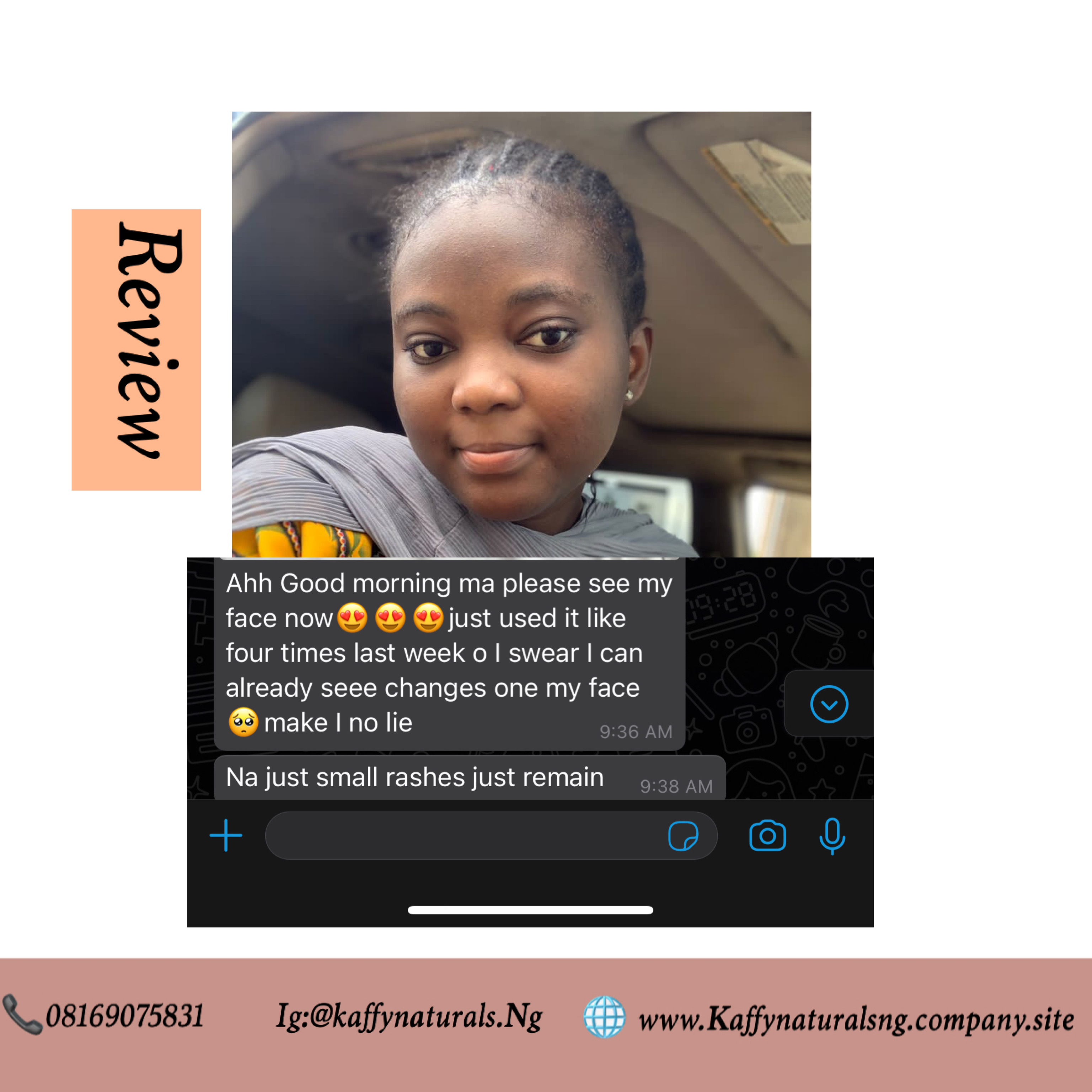 —Customer Reviews