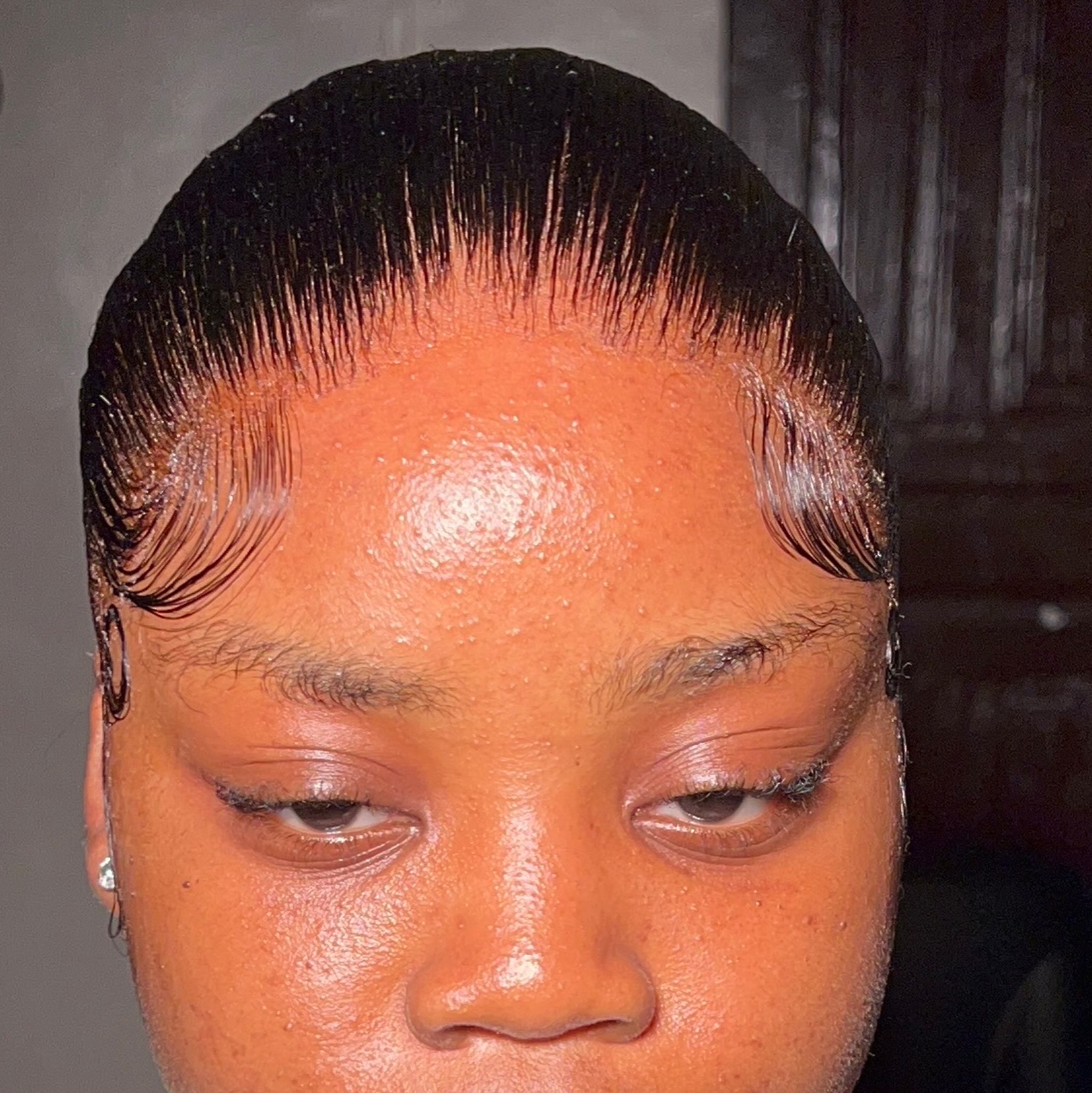 Natural Hairline installation