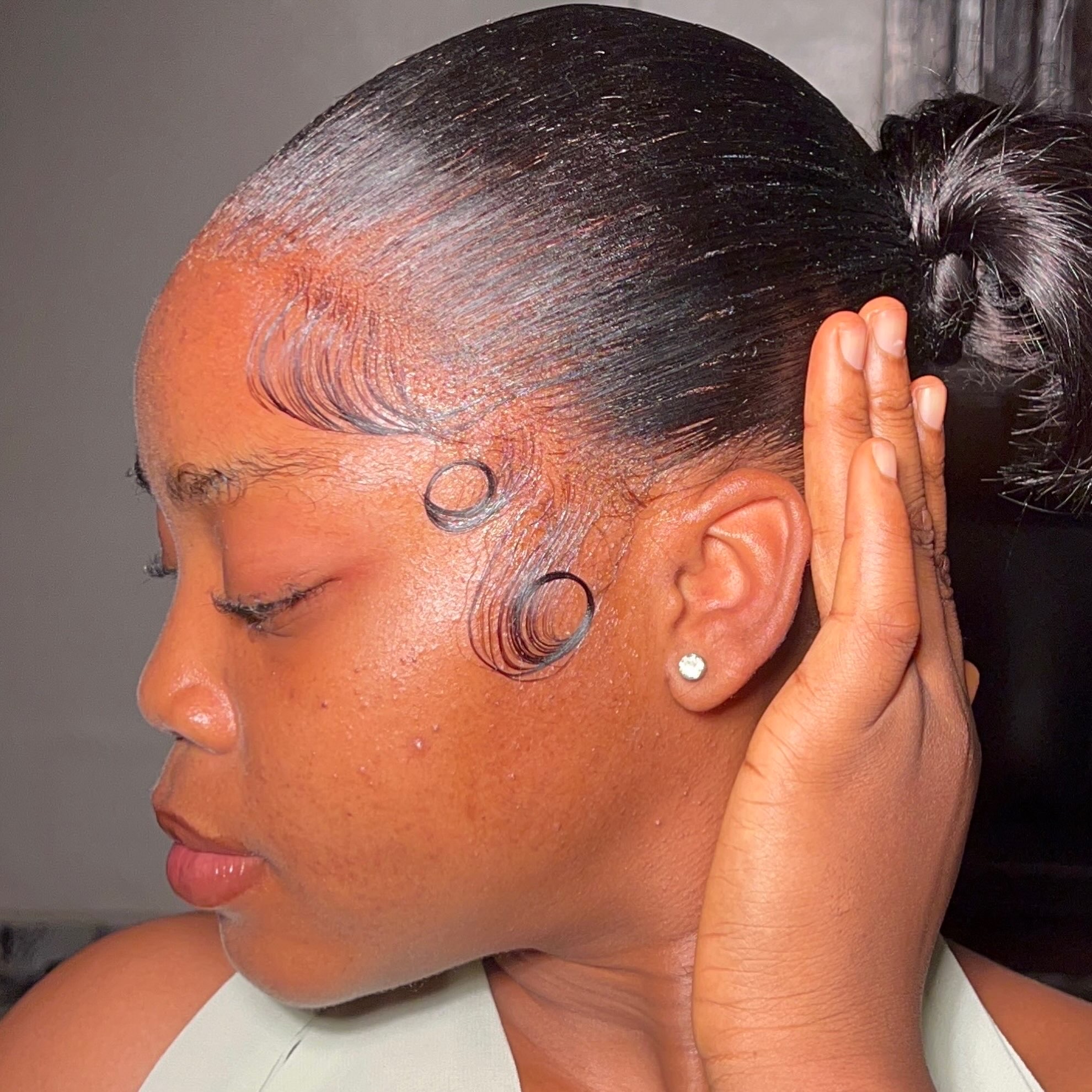 Natural Hairline installation